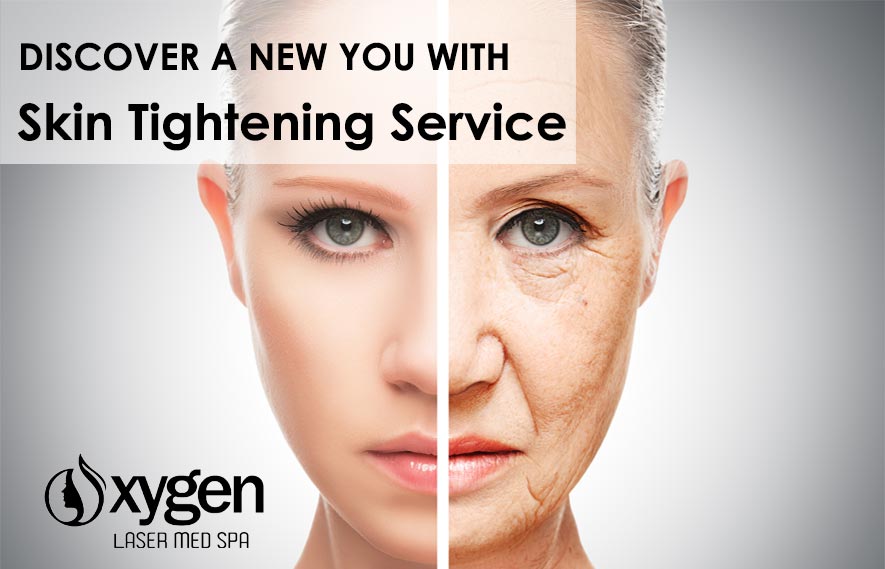 Skin Tightening Service Oxygen Med Spa