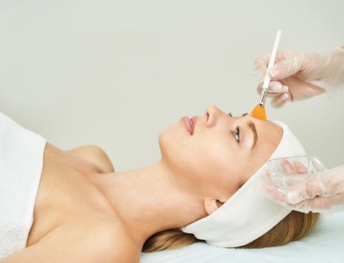 Chemical Peel vs VI Peel