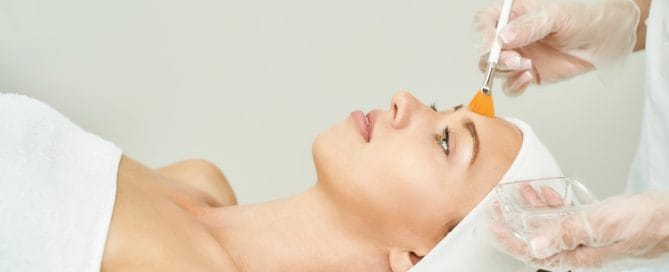 chemical peel b efore andafter