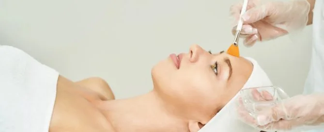 chemical peel b efore andafter