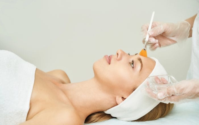 chemical peel b efore andafter