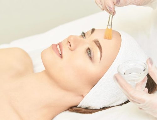 Chemical Peels Tinley Park