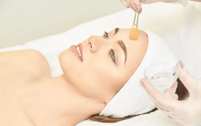 chemical peels tinley park