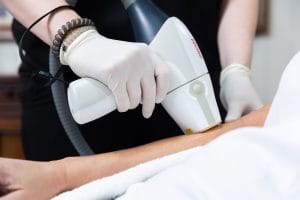 laser removal near me