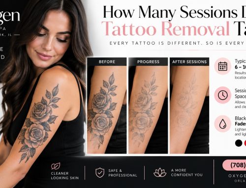 How Many Sessions Does Tattoo Removal Take?