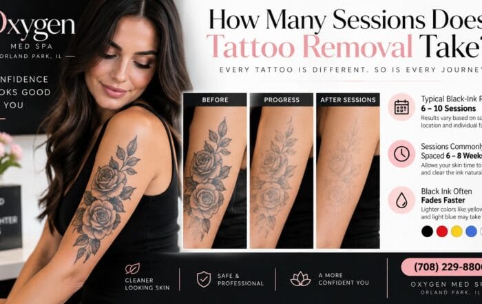 How many sessions does tattoo removal take? By Oxygen Med Spa, Orland Park — a woman with an arm tattoo beside before, progress, and after-sessions photos and a session-count breakdown