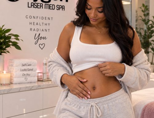 Stretch Marks: What Actually Works