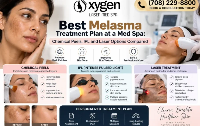Oxygen Laser Med Spa melasma treatment infographic comparing chemical peels, IPL therapy, and laser treatments for uneven skin tone and dark patches, with treatment images and a personalized skincare plan. Call (708) 229-8800 for a consultation.