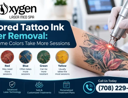 Colored Tattoo Ink Laser Removal: Why Some Colors Take More Sessions