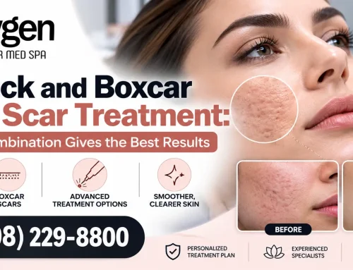 Ice Pick and Boxcar Acne Scar Treatment: Which Combination Gives the Best Results