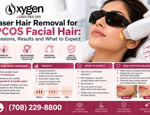 Laser Hair Removal for PCOS Facial Hair: Sessions, Results and What to Expect
