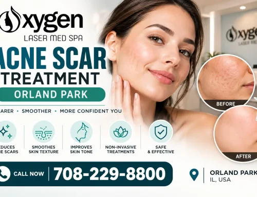 Acne Scar Treatment in Orland Park: Which Treatment Works for Your Scar Type